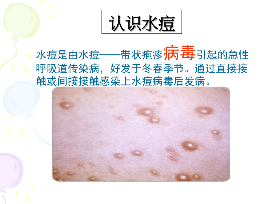 水痘预防.ppt_第2页