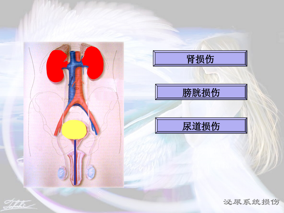 泌尿系统损伤病人的护理10324.ppt_第2页