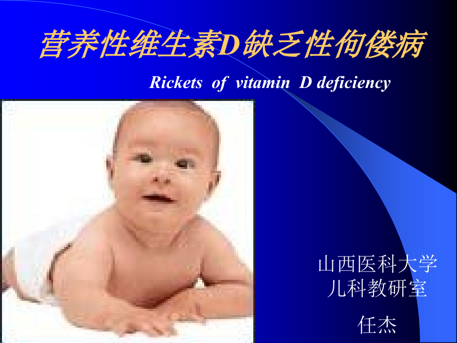 维生素D缺乏性佝偻病未用.ppt_第1页