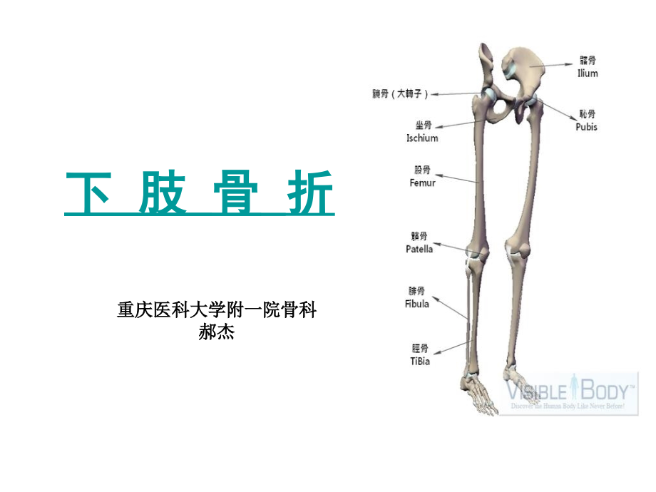 上臂骨折22323.ppt_第1页
