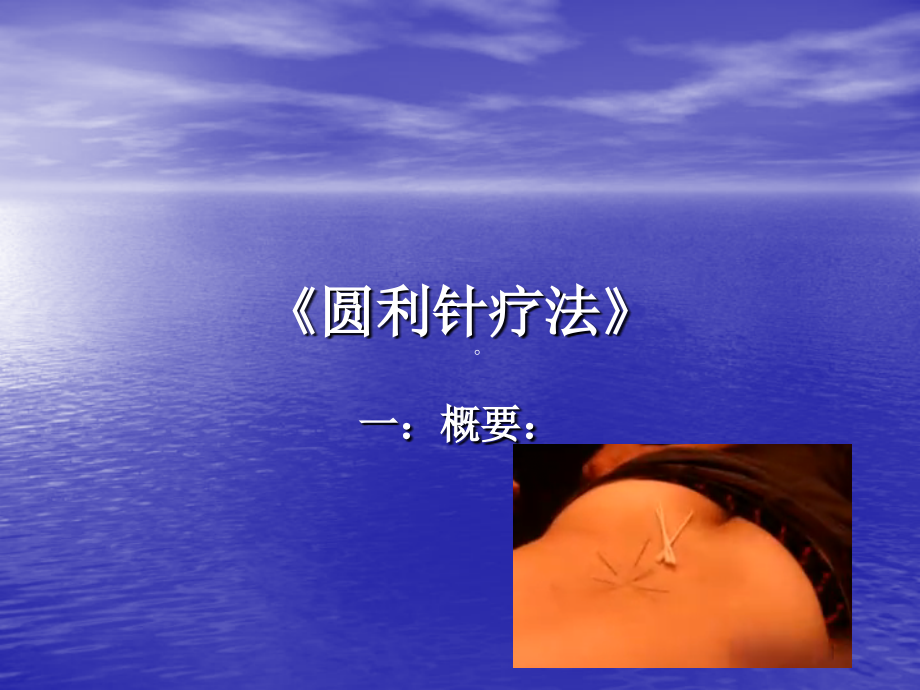 圆利针超微针刀技术.ppt_第1页