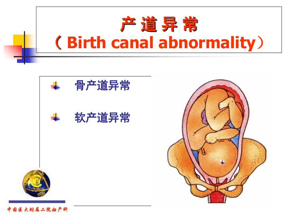产道异常.ppt_第2页