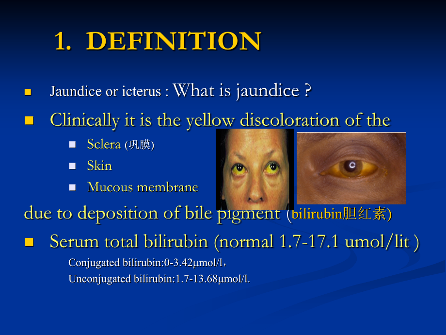 《黄疸》-09级一系-老年-麻醉-救援-心理-陶小红-12-04-181.ppt_第2页