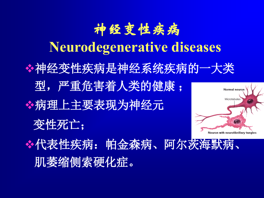 医学课件瑞金医院帕金森病.ppt_第1页