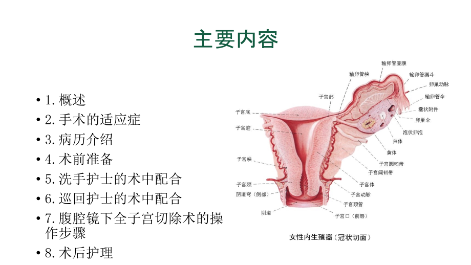腹腔镜下子宫切除手术的手术配合讲义.ppt_第2页