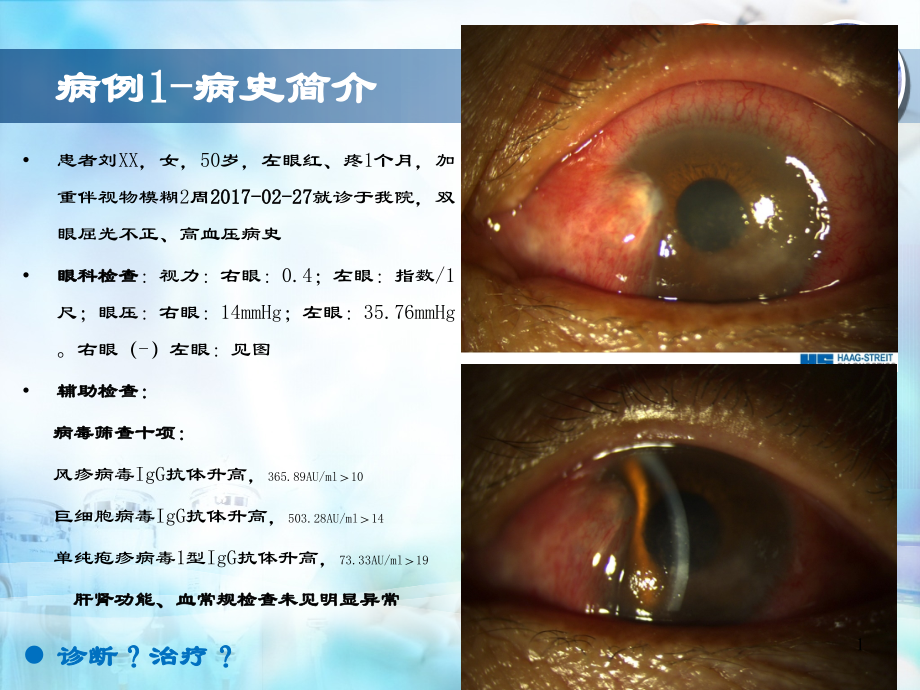 医学课件角膜内皮炎的诊断与治疗体会.ppt_第1页