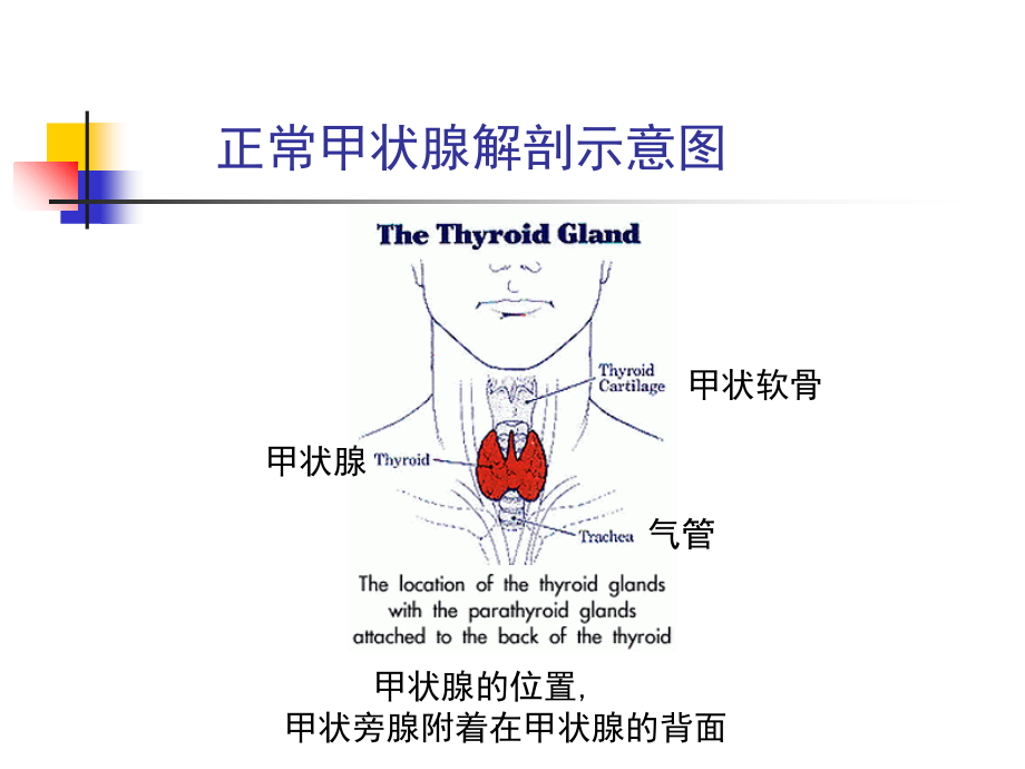 医学课件甲亢的特殊表现和处置.ppt_第1页
