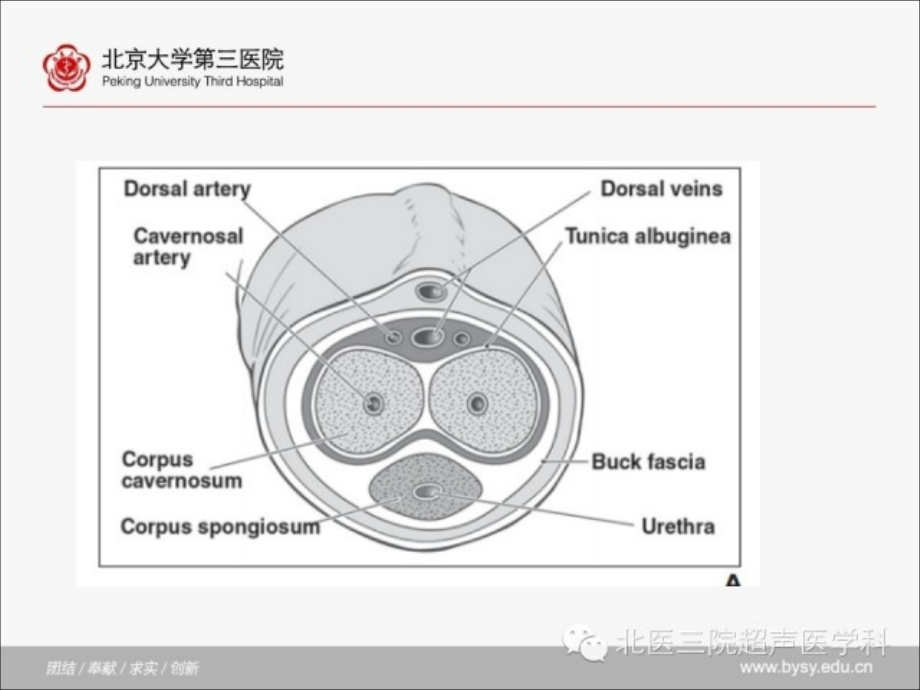 阴茎损伤的超声表现课件.ppt_第2页
