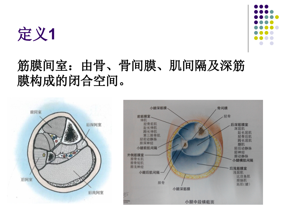 医学课件筋膜间室综合征.ppt_第1页