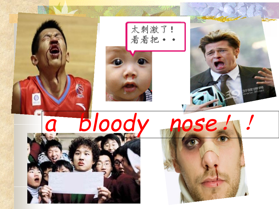 鼻出血汇总专题知识宣教-PPT医学课件.ppt_第2页