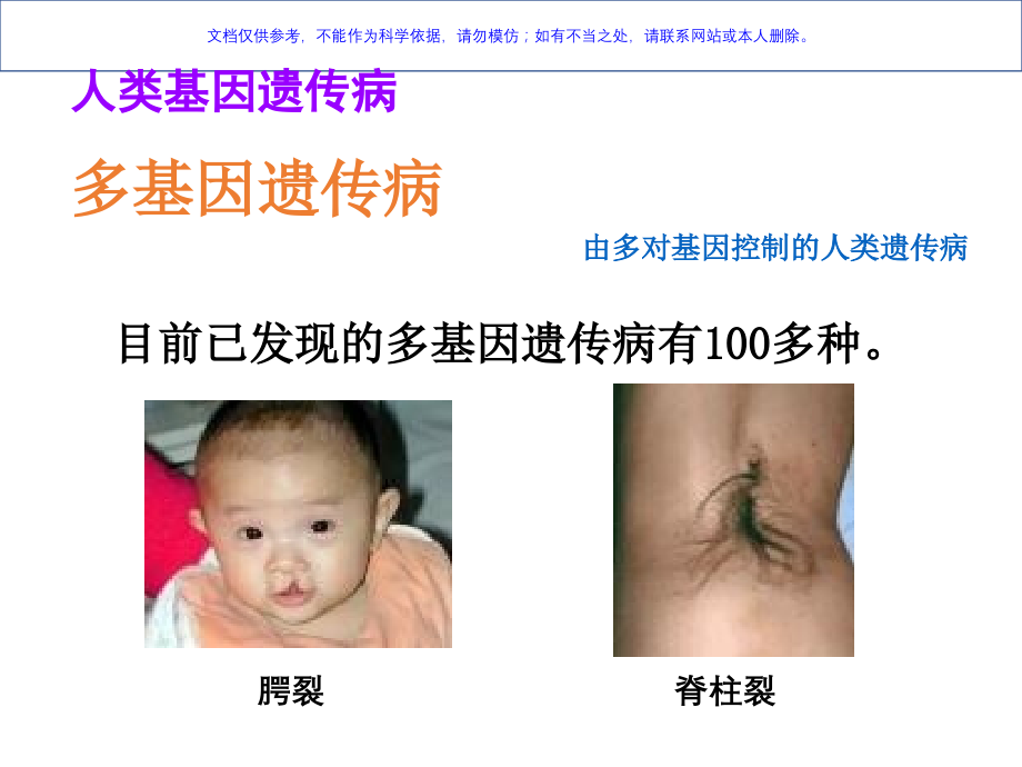 关注人类遗传病课件.ppt_第2页