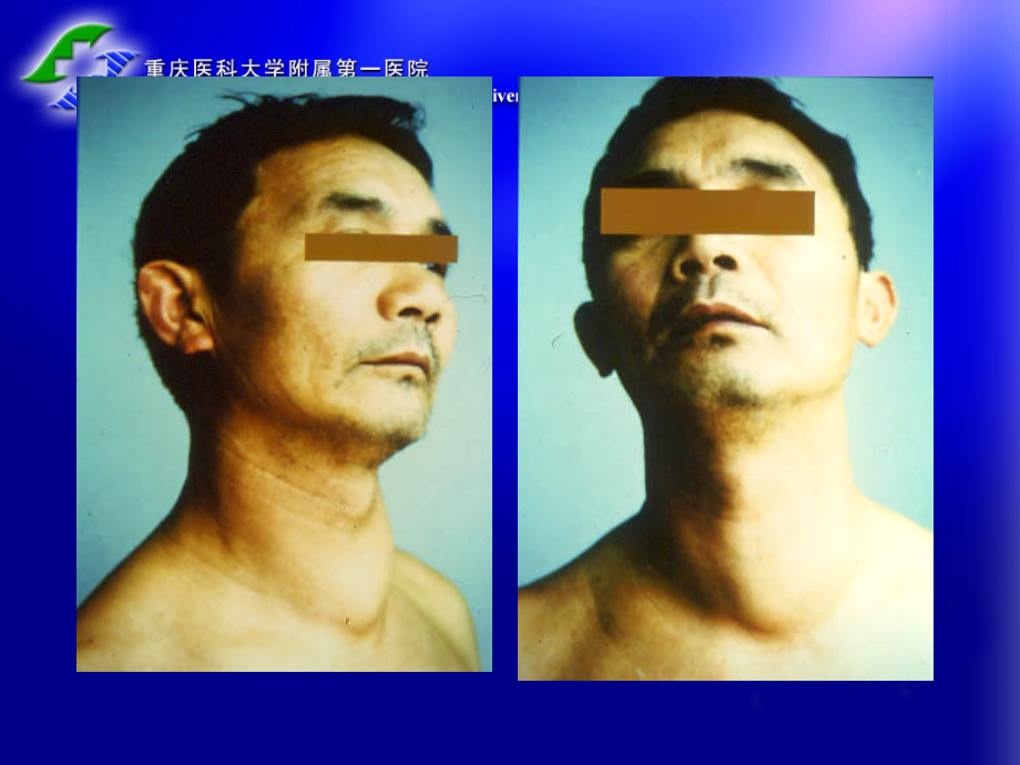 医学颈部肿块的诊断和鉴别诊断专题医学知识宣讲专题.ppt_第2页