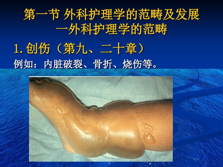 第一章外科护理学绪论.ppt_第2页