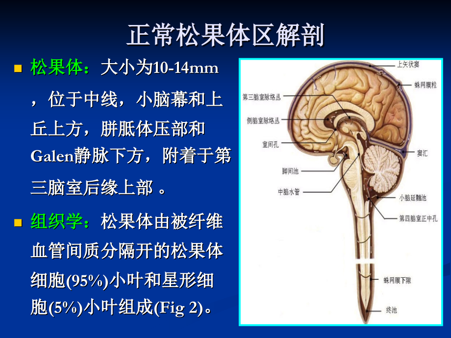 医学松果体区肿瘤专题.ppt_第2页
