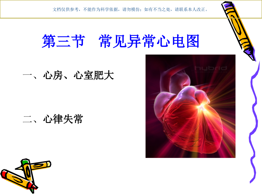 常见异常心电图课件.ppt_第1页