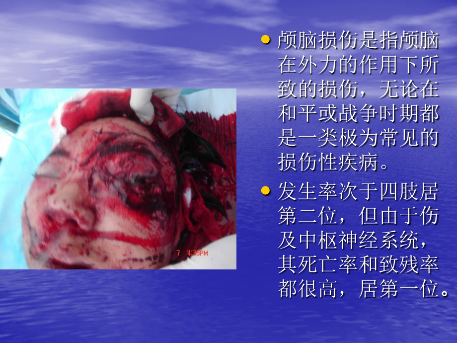 PPT医学课件颅脑损伤医学知识专题讲座讲义.ppt_第1页