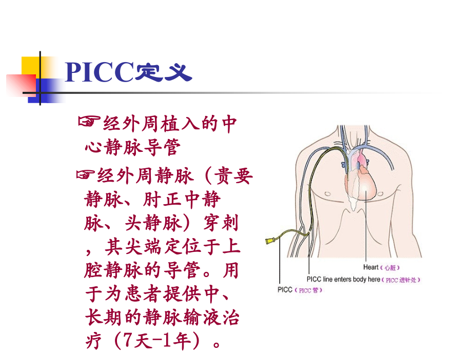 PICC维护流程.ppt_第2页