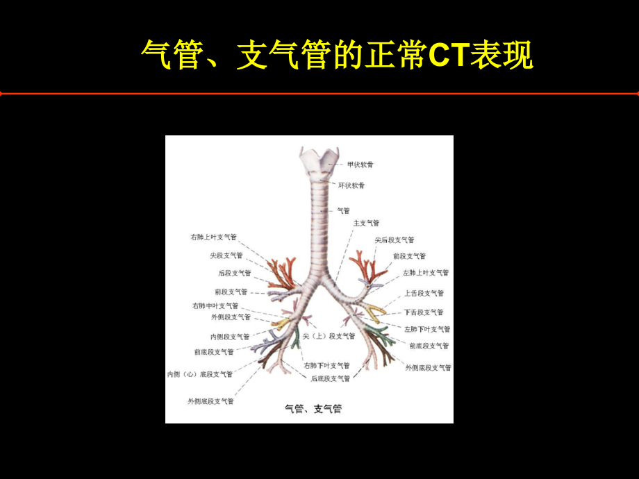 医学胸部病变的CT诊疗.ppt_第2页