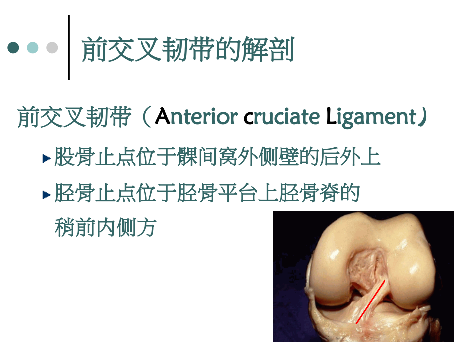医学课件关节镜下前交叉韧带重建手术的配合.ppt_第1页