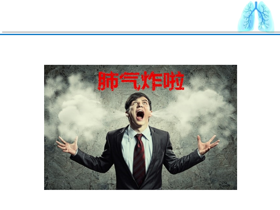 自发性气胸患者的-护理.ppt_第2页