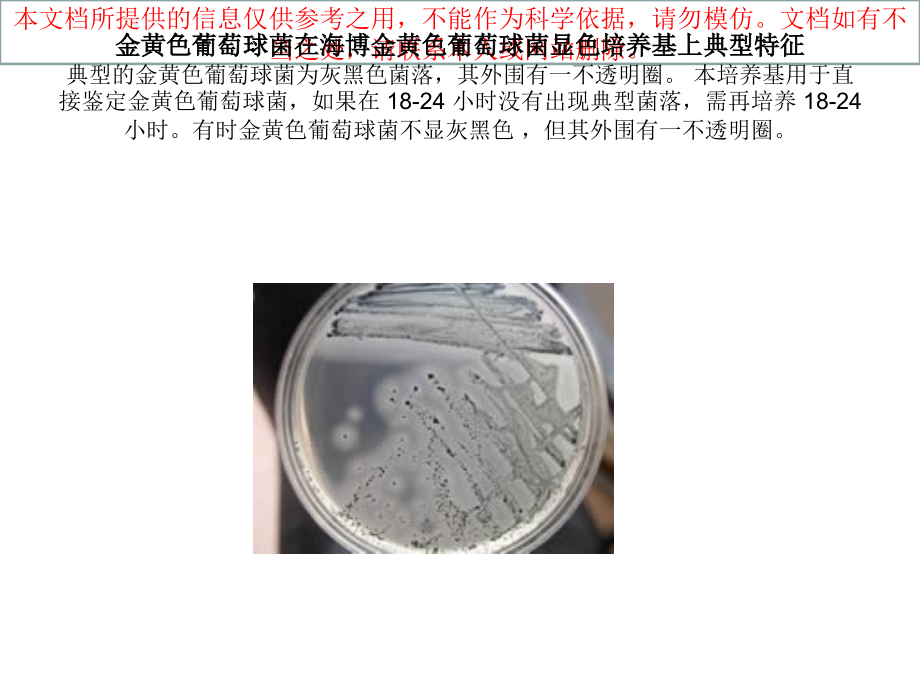 几种典型菌落特征专业知识讲座.ppt_第1页