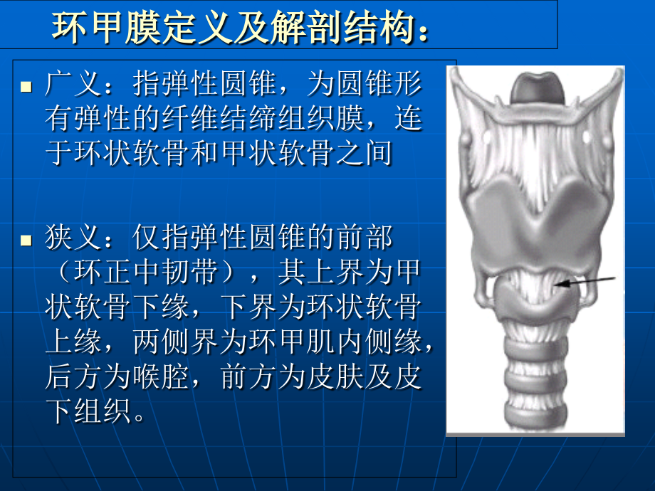 医学环甲膜穿刺术专题.ppt_第2页