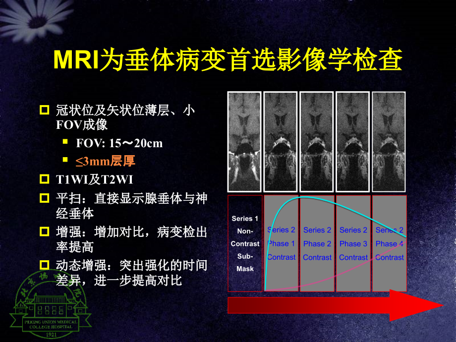 垂体病变MRI诊疗思路.ppt_第2页