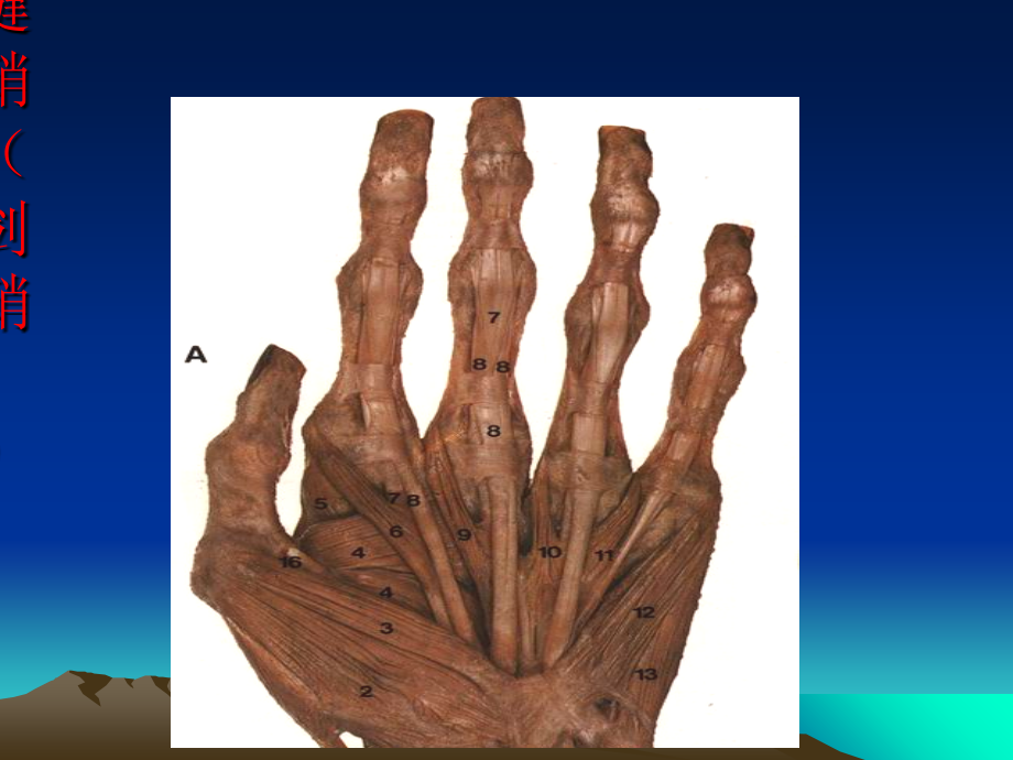 医学课件小针刀治疗腱鞘炎.ppt_第2页