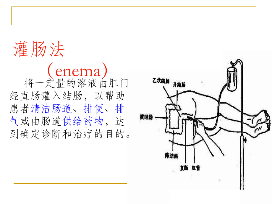 保留灌肠法专题宣讲.ppt_第2页