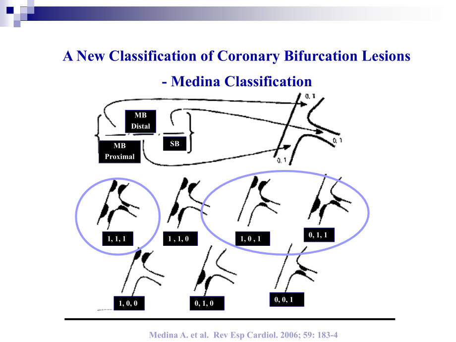 医学课件冠脉叉病变介入技巧.ppt_第2页
