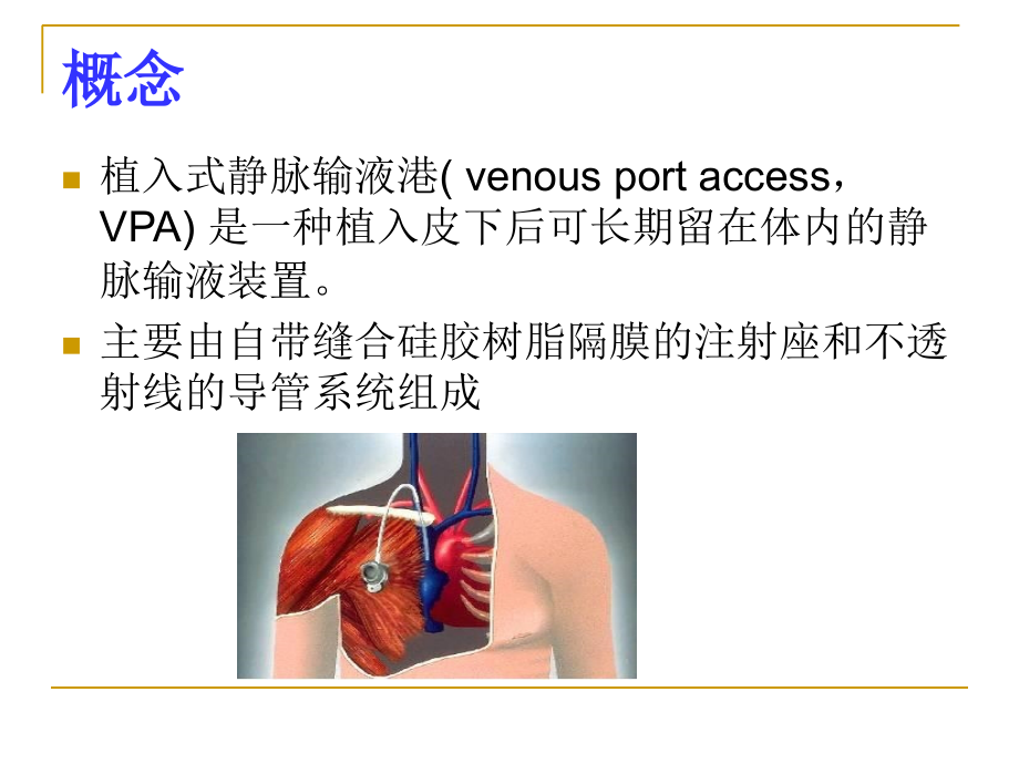 医学课件输液港护理专业知识.ppt_第2页