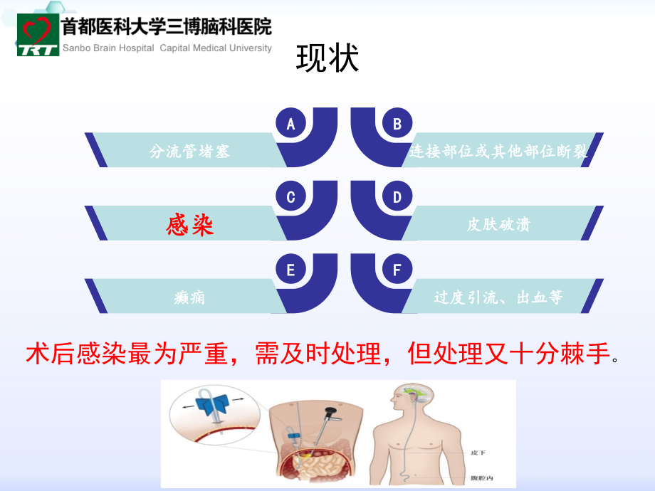 vp分流术后感染.ppt_第2页