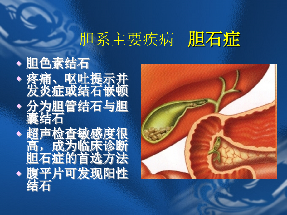 医学胆道病症医学知识宣讲.ppt_第2页