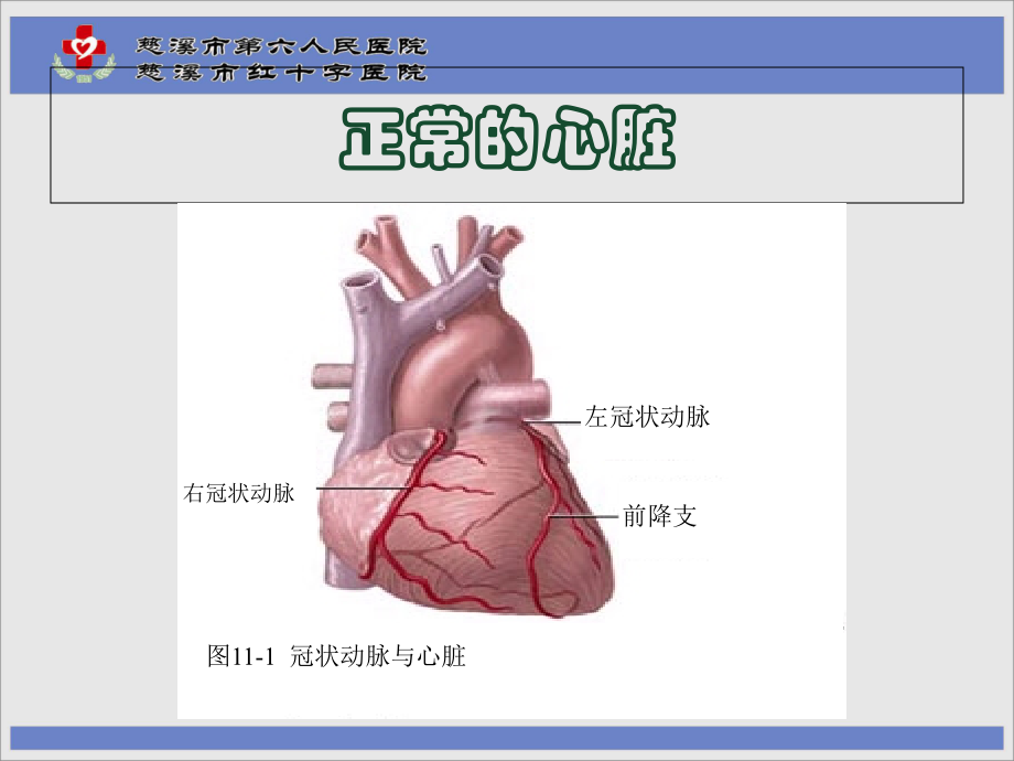 医学课件冠心病护理要点.ppt_第1页