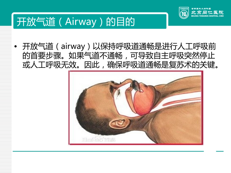心肺复苏开放气道.ppt_第2页