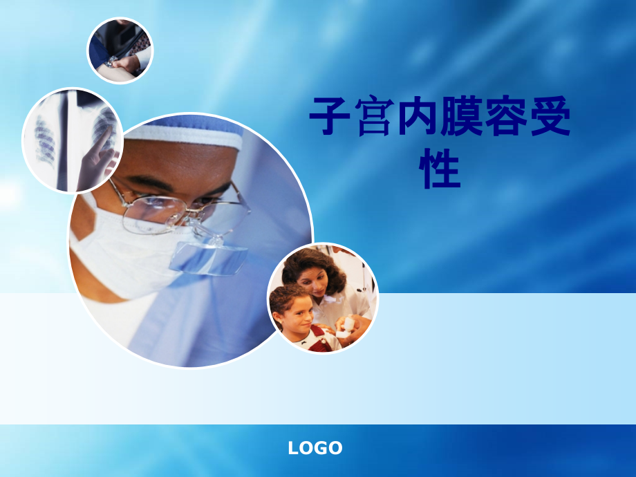 子宫内膜容受性.ppt_第1页