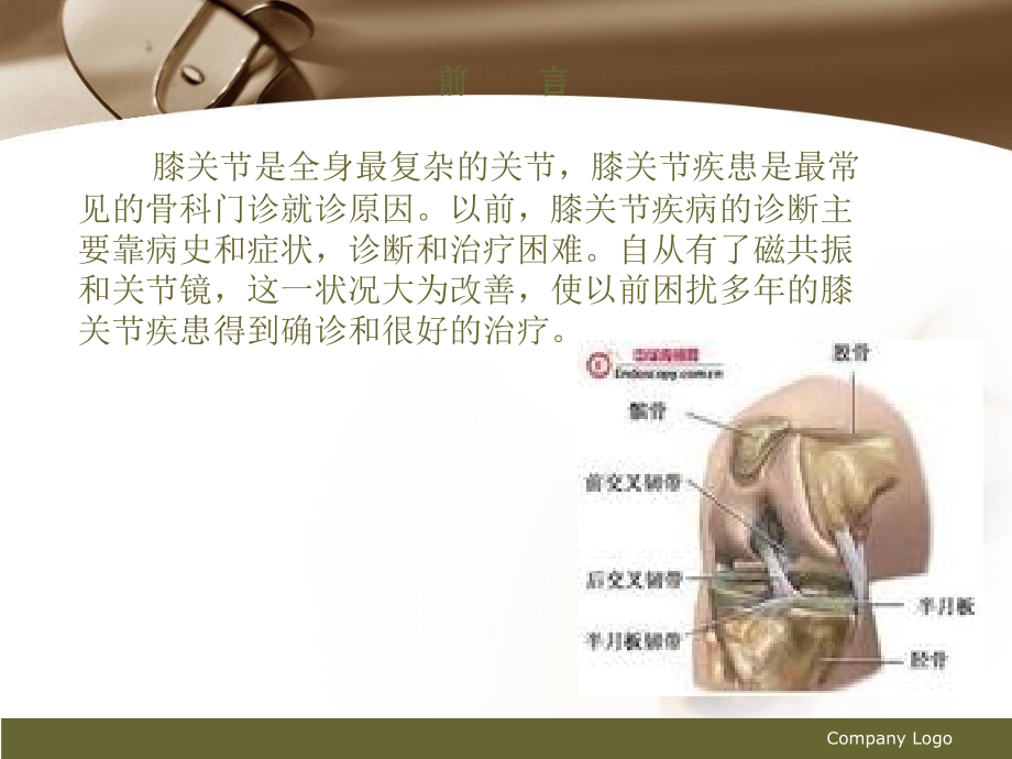 膝关节损伤的关节镜诊治总结.ppt_第2页