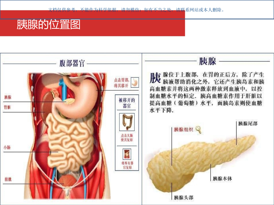 急性胰腺炎的护理课件.ppt_第2页