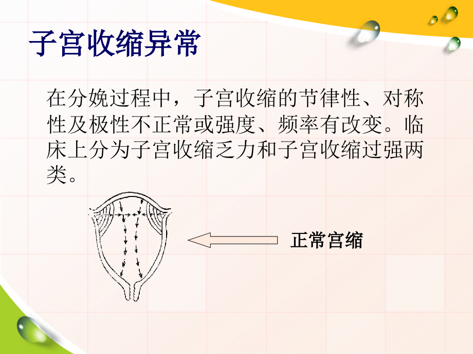 子宫收缩乏力.ppt_第2页