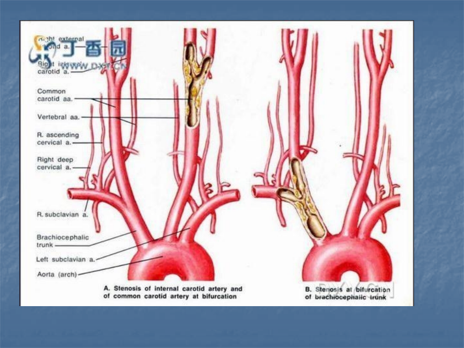 医学课件颈动脉超声检查规范.ppt_第1页