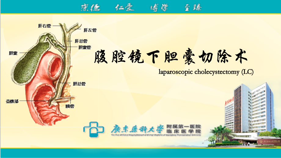 腹腔镜胆囊切除术(详细讲解).ppt_第1页