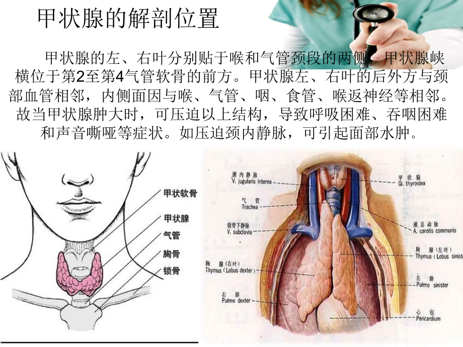 医学课件甲状腺癌术后护理.ppt_第2页