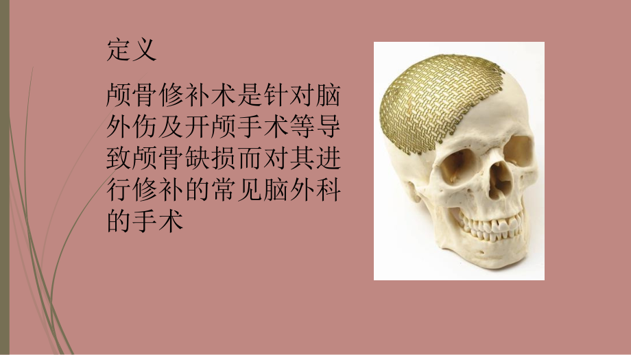 PPT医学课件颅骨修补护理讲义.ppt_第1页