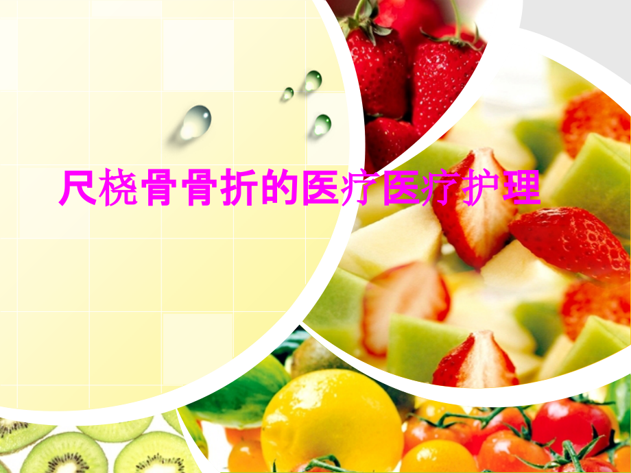 医学尺桡骨骨折的医疗医疗护理.ppt_第1页
