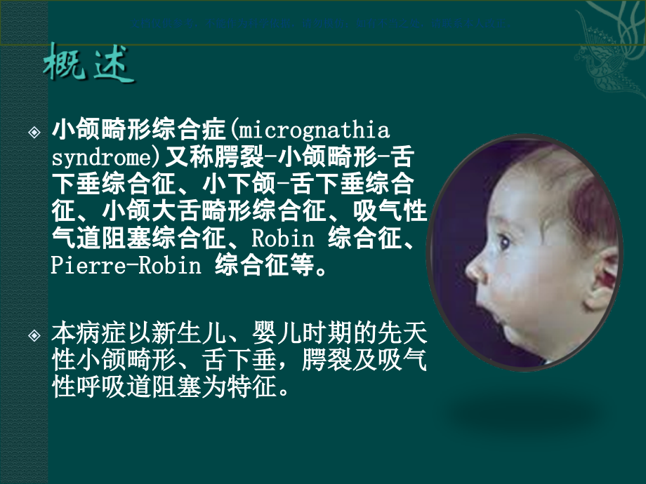 小下颌畸形综合征课件.ppt_第1页