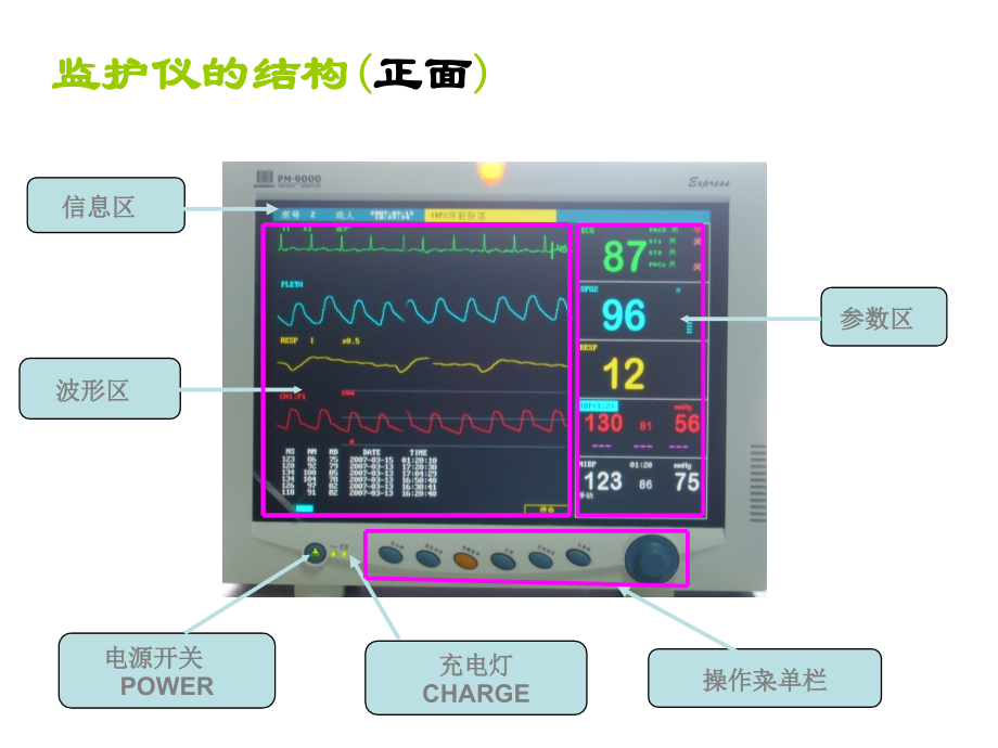 心电监护仪的使用PPT.ppt_第2页