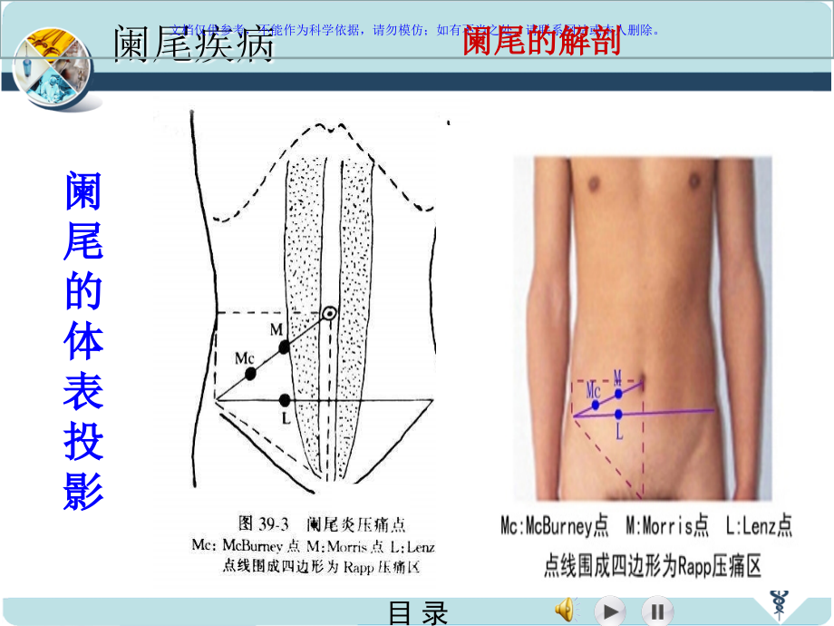 急性阑尾炎宣讲课件.ppt_第2页