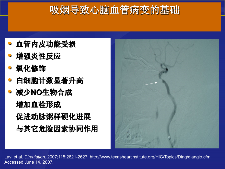 吸烟和神经系统疾病课件.ppt_第2页