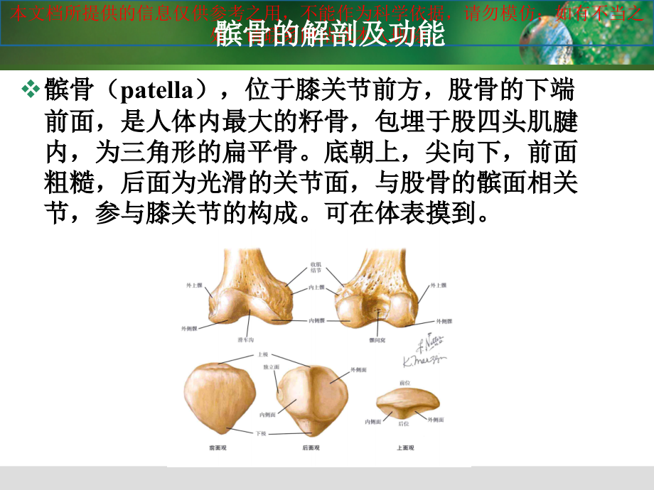 急性髌骨脱位宣教培训课件.ppt_第1页