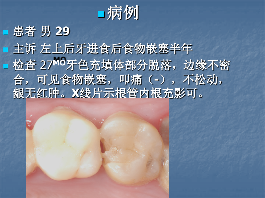 医学分段成型片的临床应用ppt.ppt_第2页